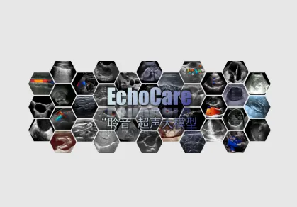EchoCare：基于自监督学习的开源超声影像基础模型，支持多中心多设备泛化