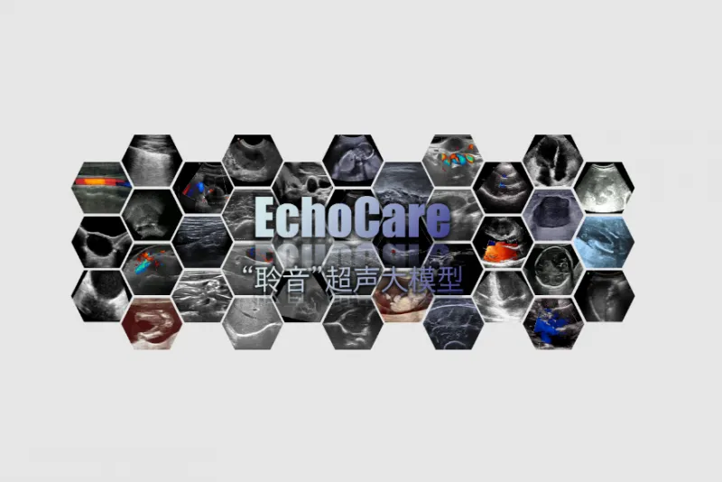 EchoCare：基于自监督学习的开源超声影像基础模型，支持多中心多设备泛化